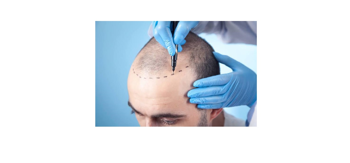 Seda Şentürk Hair Transplant&Esthetic